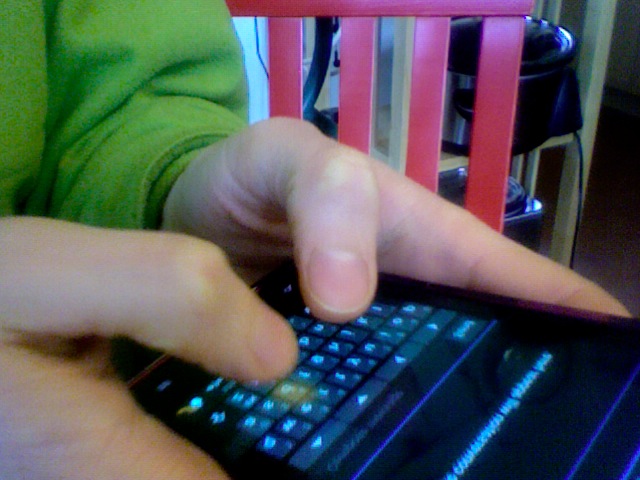 The dreaded texting thumb